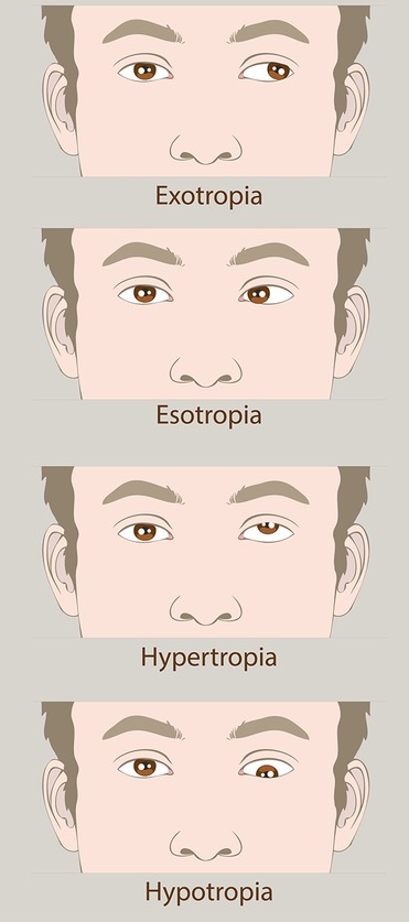 Rehabilitative Treatment